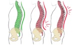 Die Gesunderhaltung des Skeletts