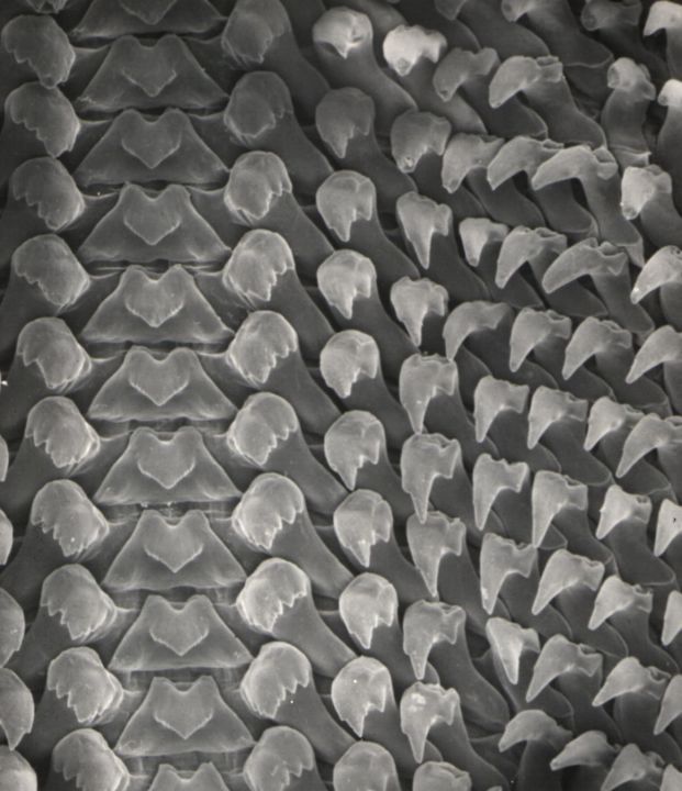 Hornzähnchen der Raspelzunge unter dem Elektronenmikroskop